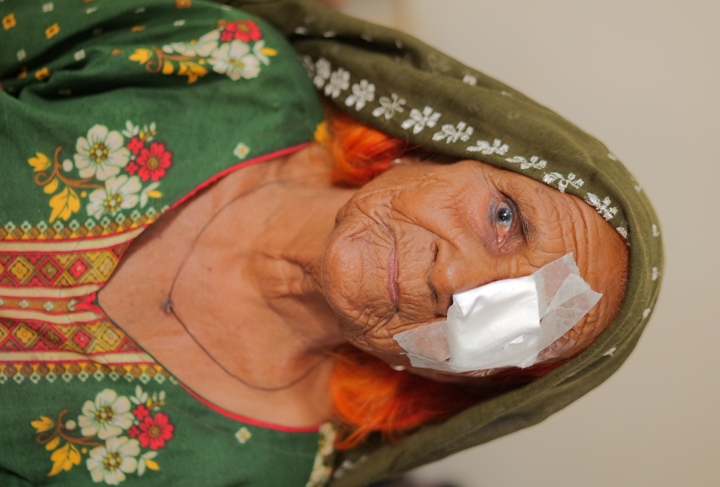 Cataract Surgeries in Pakistan