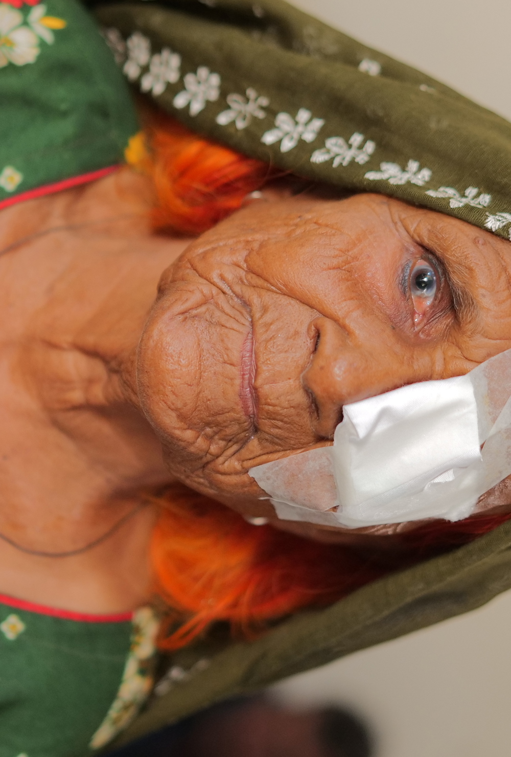 Cataract Surgeries in Pakistan